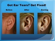 Got Ear Tears, Get Fixed